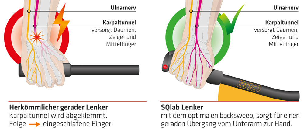 SQLab Fahrradlenker